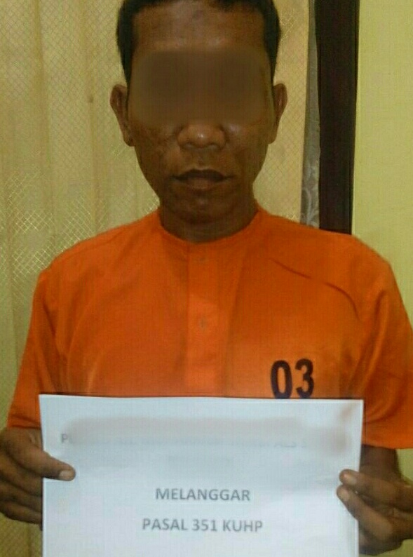 Hanya Karena Kontak Mata, MS Tega Aniaya Karyawan PT. THIP Tanjung Simpang